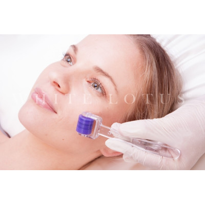 White Lotus Anti Aging Dermaroller Lotus Roller™ — Trattamento White Lotus Anti Aging Dermaroller Lotus Roller™ — Trattamento